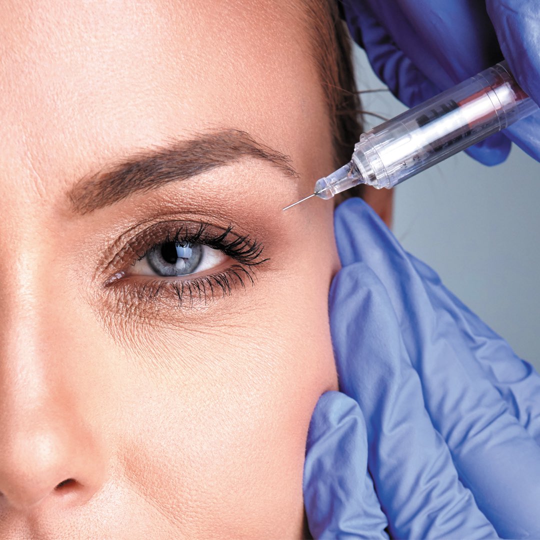 In Aesthetic Feature | BOTULINUM TOXIN COMPLICATIONS
lnkd.in/gq5fxEe

#primejournal #aesthetic #antiageing #peerreview #cosmeticmedicine #aestheticfeature #Botulinumtoxin #complications #ptosis #injections #wrinkles #mimicactivity