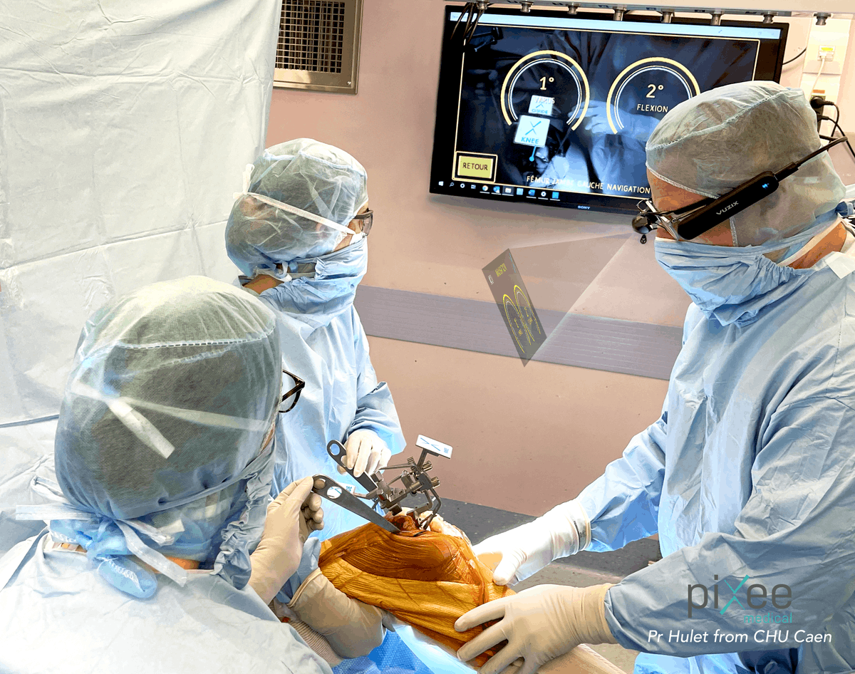 Pixee Medical (@pixeemedical) on Twitter photo <a href="/PixeeMedical/">Pixee Medical</a> is proud to announce that its Knee+ AR Computer Assisted Orthopedic solution received 510(k) clearance from the US FDA. The approval is opening the US market, with a focus on ASC, and will accelerate the excellent sales momentum observed in Europe and Australia. <a href="/PixeeMedical/">Pixee Medical</a> is proud to announce that its Knee+ AR Computer Assisted Orthopedic solution received 510(k) clearance from the US FDA. The approval is opening the US market, with a focus on ASC, and will accelerate the excellent sales momentum observed in Europe and Australia.