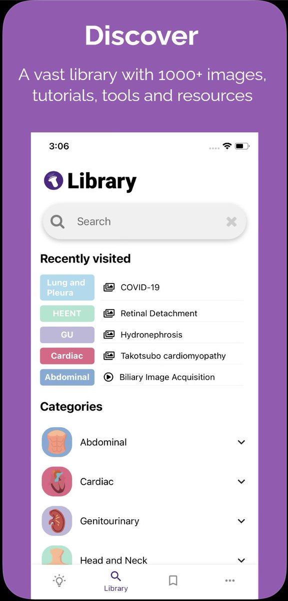 Need a mobile resource for POCUS Education? Check out this new FREE app created by experts and students. One-stop shop for all things POCUS with a huge library of clips, videos and tools with frequent updates

Apple: apps.apple.com/us/app/sono/id… 
Android: play.google.com/store/apps/det…
