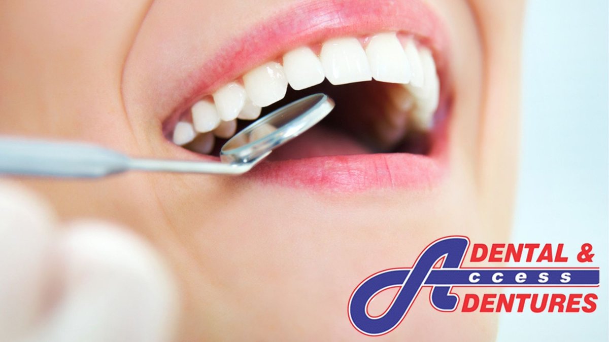 AccessDental2's tweet photo. The backs of teeth can get overlooked - They're almost impossible to see, after all! 

Make sure you spend just as much time brushing the back of your teeth as you do brushing the front. And visit a dentist regularly to check on your dental health. 💯✨

https://t.co/tYyXfoleNk https://t.co/PXrU8nB74p