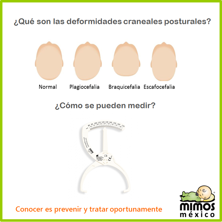 CojinMimosMex's tweet image. Las deformidades craneales posturales son aplanamientos en la 👶🏻cabecita de los bebés que aparecen durante los primeros meses de vida, debido a que la cabecita es muy maleable durante esta etapa. #plagiocefalia #cojinmimos #mimospillow #braquicefalia #bebes