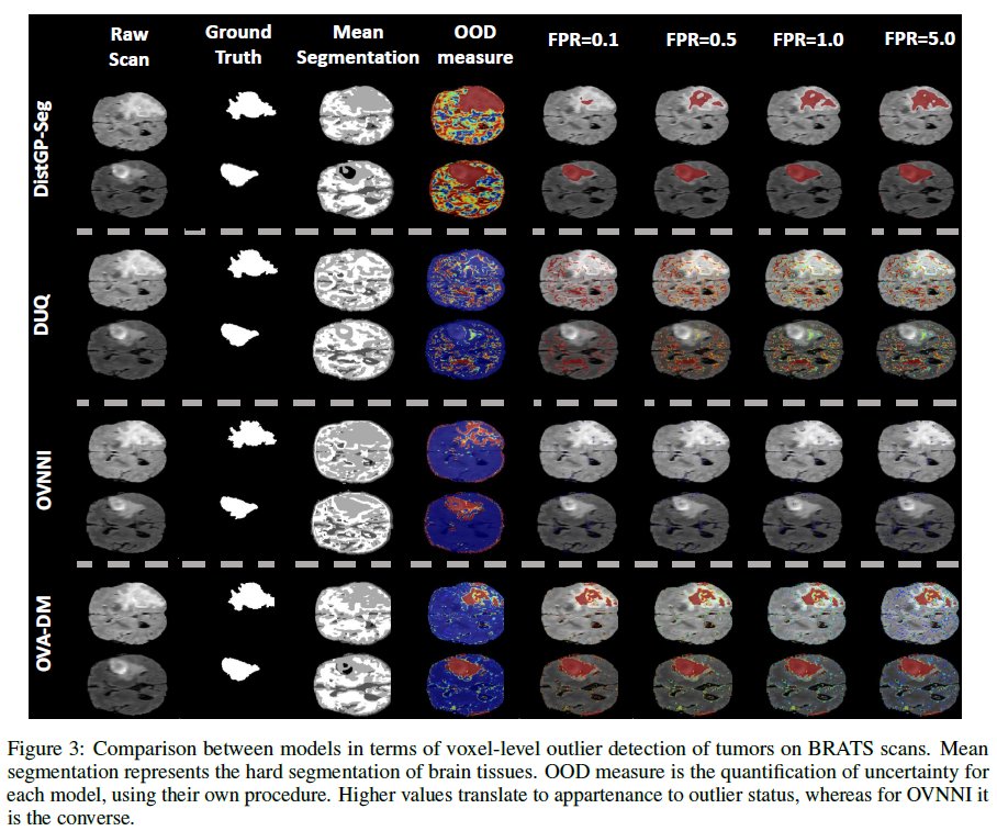 SebastianGP13's tweet photo. We trained our network to segment white matter, gray matter and cerebrospinal fluid on healthy T2 scans (normative data). 
At testing time, we used BRATS (T2 scans with tumors) to assess the capability of our model to detect tumors as outliers. https://t.co/vS19OzGWn5