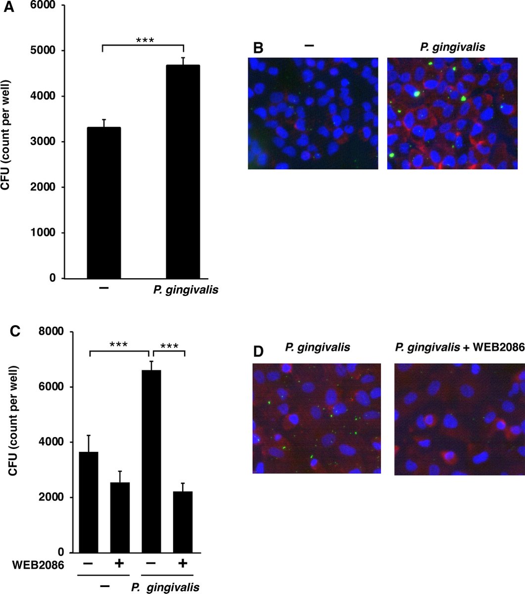 FEBS_Letters's tweet photo. #Porphyromonas gingivalis enhances #pneumococcal adhesion to human alveolar epithelial cells by increasing expression of host platelet-activating factor receptor
➡https://t.co/wifk3RJQTv
#Streptococcus #penumoniae #gingipains #periodonal #inflammation https://t.co/a4agXXdnTd