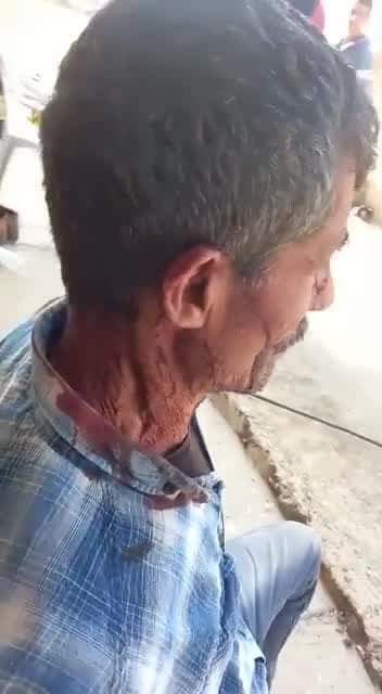 Israeli Settlers Brutally Assaulted And Wounded This Palestinian Herder Near The Town Of Ya Bad In The North Of The Occupied West Bank Today Pic Twitter Com E71nzp1ku6 P Online9