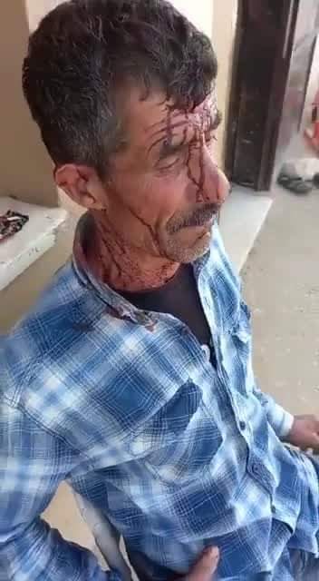 Israeli Settlers Brutally Assaulted And Wounded This Palestinian Herder Near The Town Of Ya Bad In The North Of The Occupied West Bank Today Pic Twitter Com E71nzp1ku6 P Online9