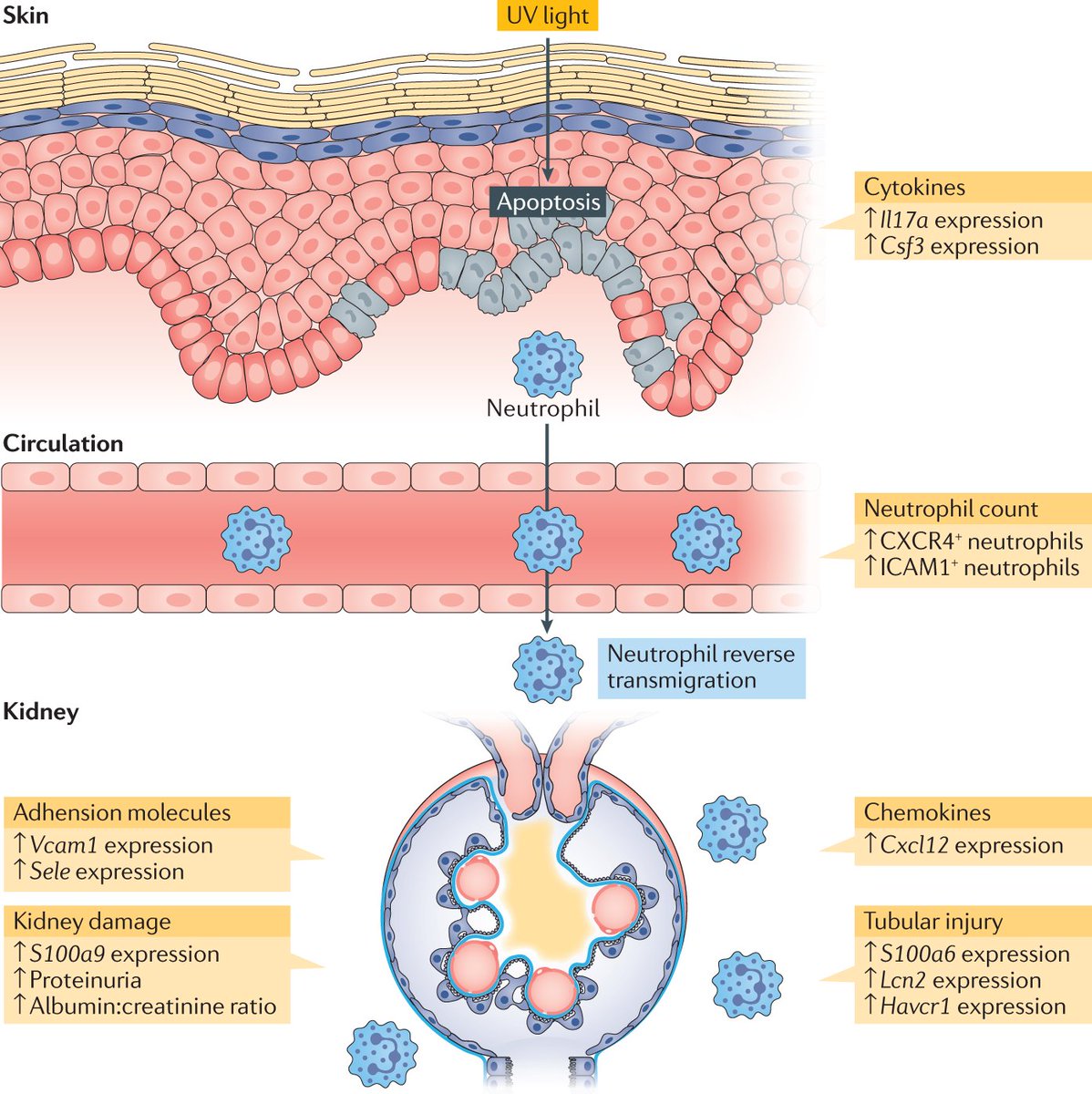 NatRevRheumatol's tweet image. #MayIssue | A multitude of factors contribute to SLE through effecting immune and tissue resident cells. 

Learn about skin–kidney crosstalk in #lupus in our #NewsAndViews article from @GeorgeTsokos and @KoliosAntonios

#DayOfImmunology #Immunology

go.nature.com/3u10KI6