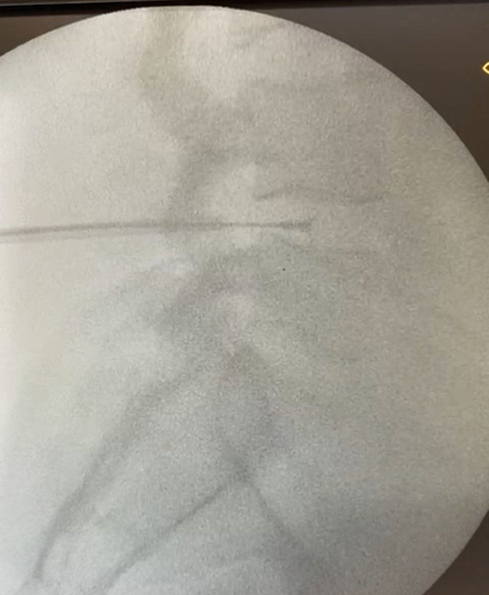 Anestesia Clínico Valencia tweet media