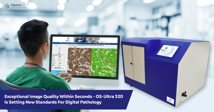 InstaaPR's tweet photo. OptraSCAN Unveils OS-Ultra 320 First Ever High-Speed Scanner at Economical Pricing
Read More : https://t.co/mHyYixNa2r
#InstaaPR #PressRelease #OptraScan #HighspeedScanner https://t.co/TyGyMG8KAV