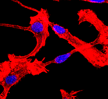 parkerici's tweet photo. 1/ On #DayofImmunology🔬 we're sharing three reasons why one of our favorite immune cells is the DENDRITIC CELL:

1️⃣ They are the professional antigen presenting cells capable of taking up, processing and presenting antigens to CD4+ and CD8+ T cells. https://t.co/44rc4TmJ8y