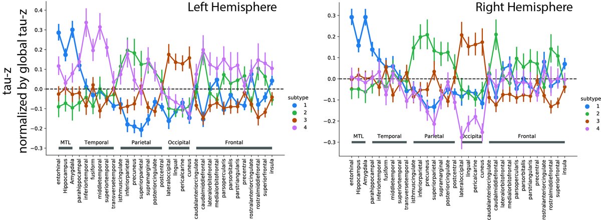 Applying SuStaIn to this dataset, we found four distinct spatiotemporal patterns, including limbic-predominant and MTL-sparing variants similar to those described by  @DrNeuroChic, as well as posterior and lateral temporal subtypes resembling the clinical variants, PCA & lvPPA 6/