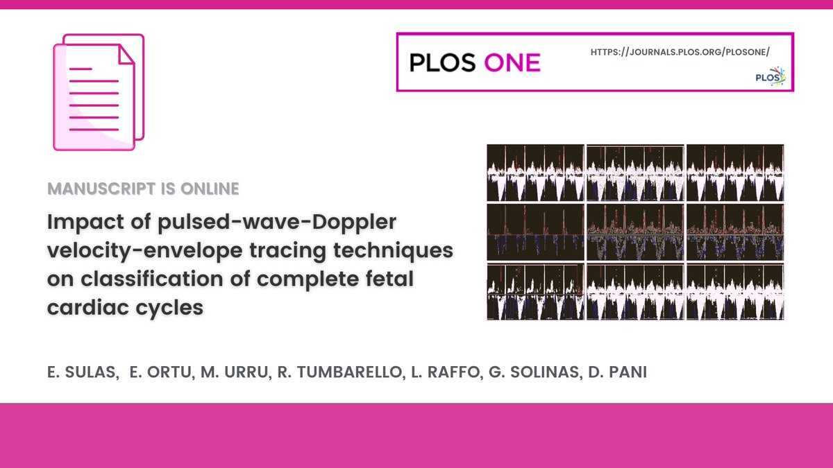 This methodological study on #fetalcardiacmonitoring deals with the classification of complete #fetalheartcycles. The results are important for researchers interested in the development of #PWD processing techniques.
📑Article is now available in <a href="/PLOSONE/">PLOS One</a>: tinyurl.com/r28y92k