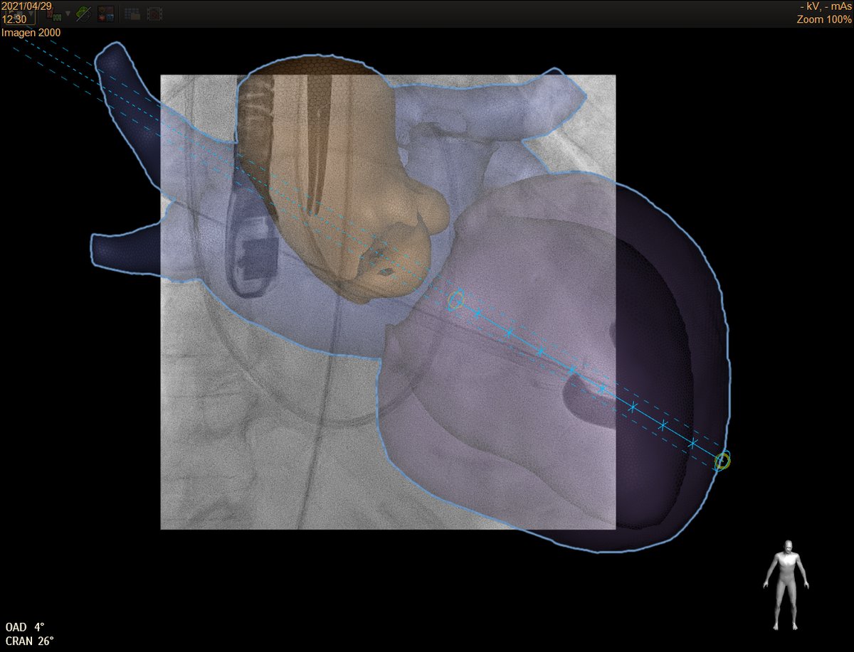Manuel Barreiro-Perez tweet media
