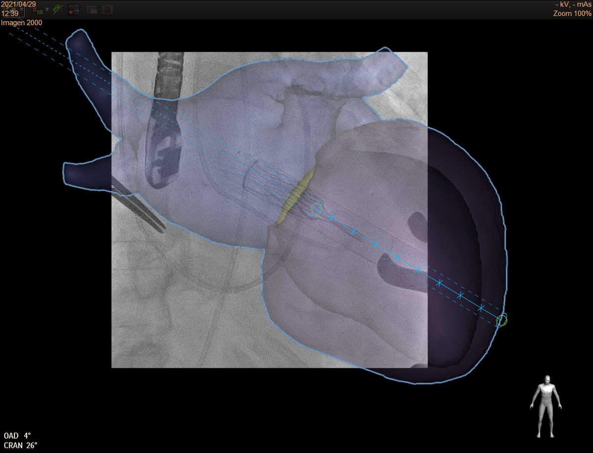 Manuel Barreiro-Perez tweet media
