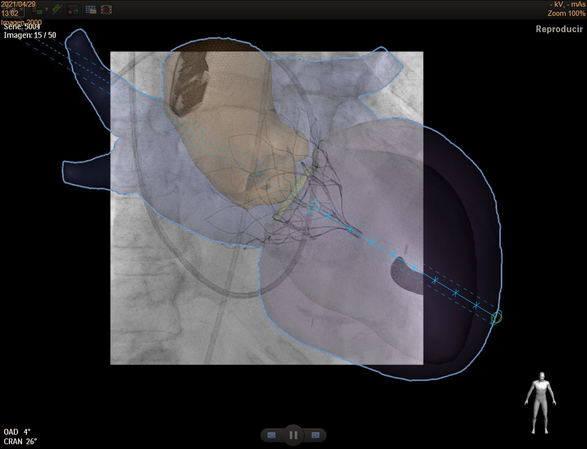 Manuel Barreiro-Perez tweet media
