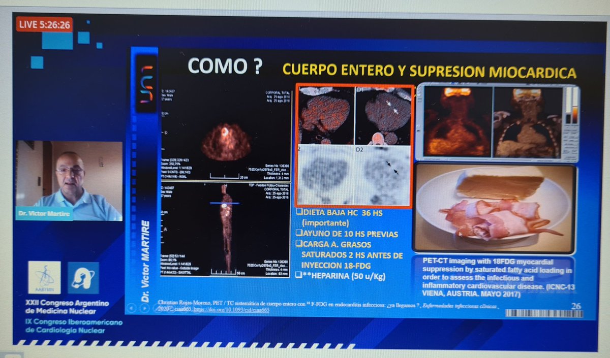 SACnuclear's tweet photo. Conferencia #Endocarditis Evaluacion con PET/TC -Dr Victor Martire 💯 
Coord: Dr. Marcelo Rodriguez @NeivaMaciel_doc  @AacNuclear
@AAByMN1  @SADI_ORG @fcdnArg @SociedadeRio @sbc_cientifico @sac_hit @SIAC_MCP @TomoResoSac @consejoEcoSAC @ArgerichUco  @fermerani @GeronazzoJose https://t.co/dH3IIjHUoi
