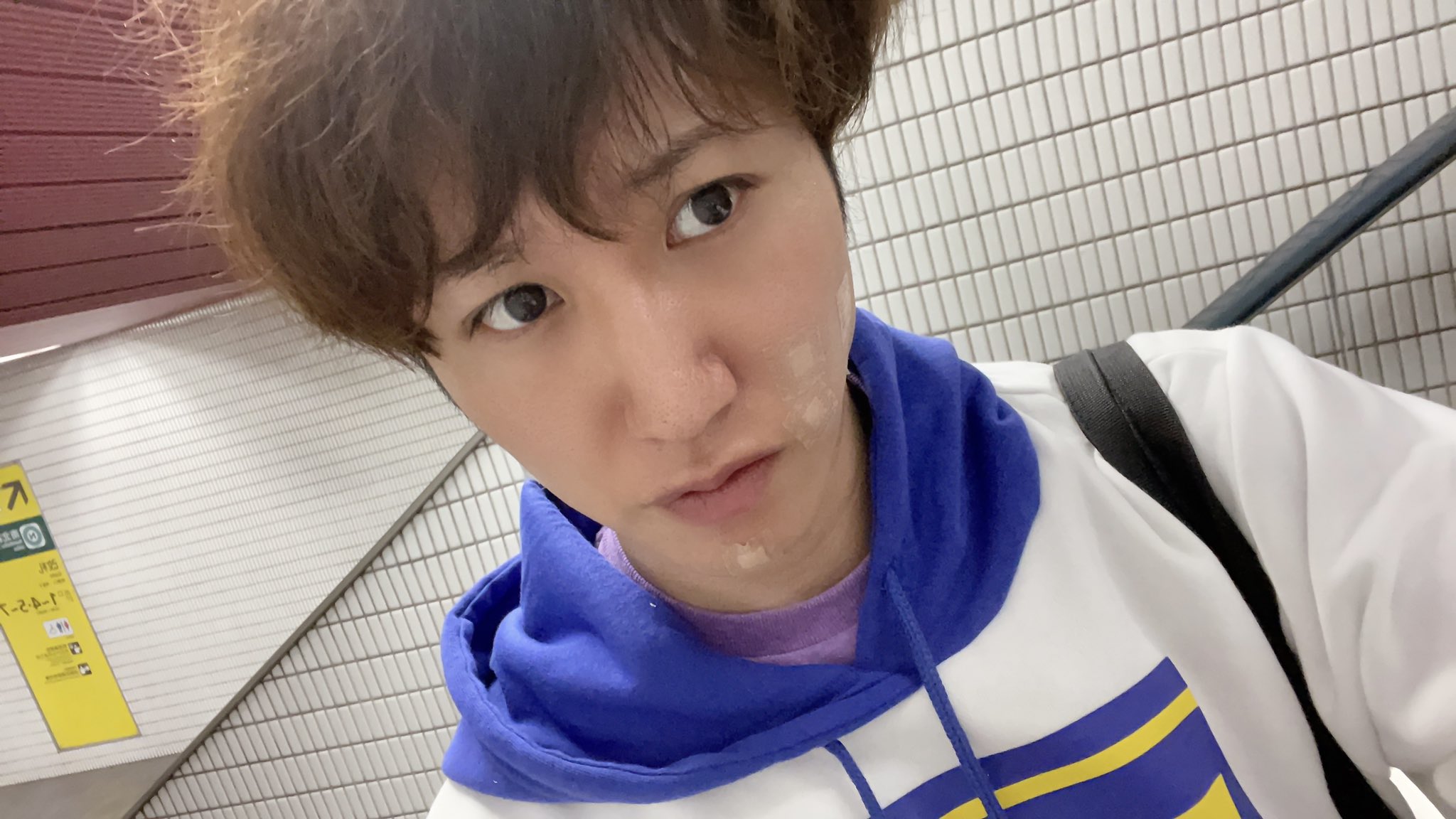 しんやっちょ サブ垢 在 Twitter 上 顔が穴だらけやで Ww 綺麗なお兄さんはお好きですか 前回の首のシコリと顔ホクロ 除去に続き今回も 顔ホクロと 首シミや血のあとみたいな 炭酸ガスによるレーザーで取った 保険きかず実費手術円 6箇所レーザーで皮膚の 表面