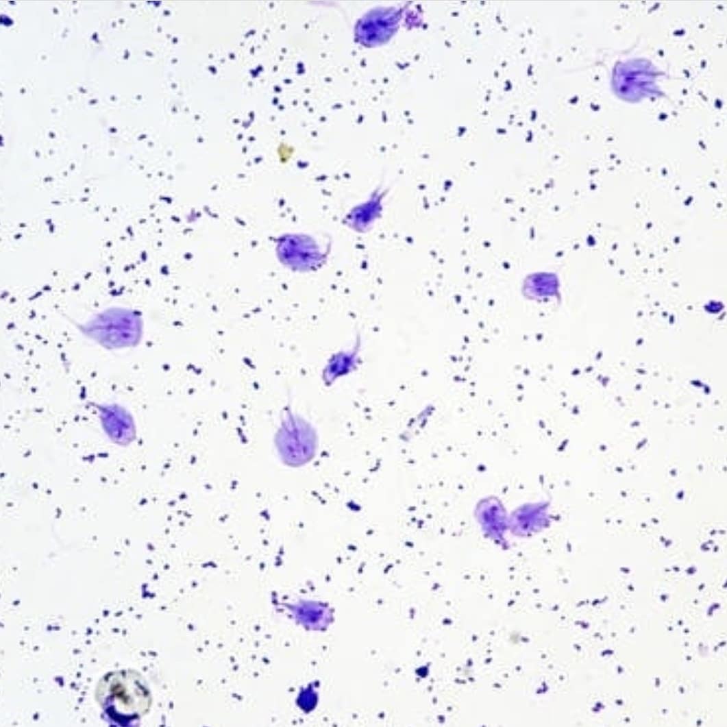 mICROBIOsh's tweet photo. Trofozoitos de Giardia lamblia. 🤩🔬💕 https://t.co/azfE45oiwT