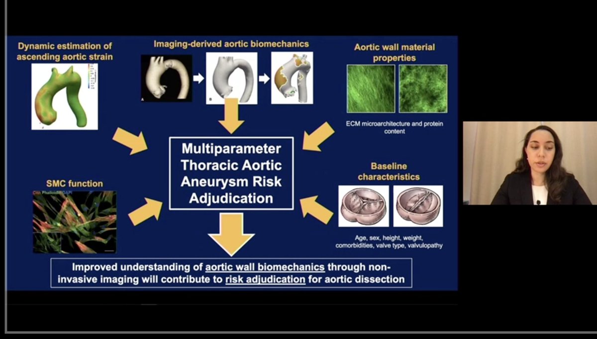 Dr. Huckaby argues for a multiparameter approach to risk adjudication for aortic dissection. Role of aortic biomechanics is being increasingly recognized! #AATS2021 <a href="/jenn_cy_chung/">Jennifer Chung</a> <a href="/thaiscoutinhoCV/">Thais Coutinho</a> <a href="/tssmn/">CTSurgSocMedNetwork</a>