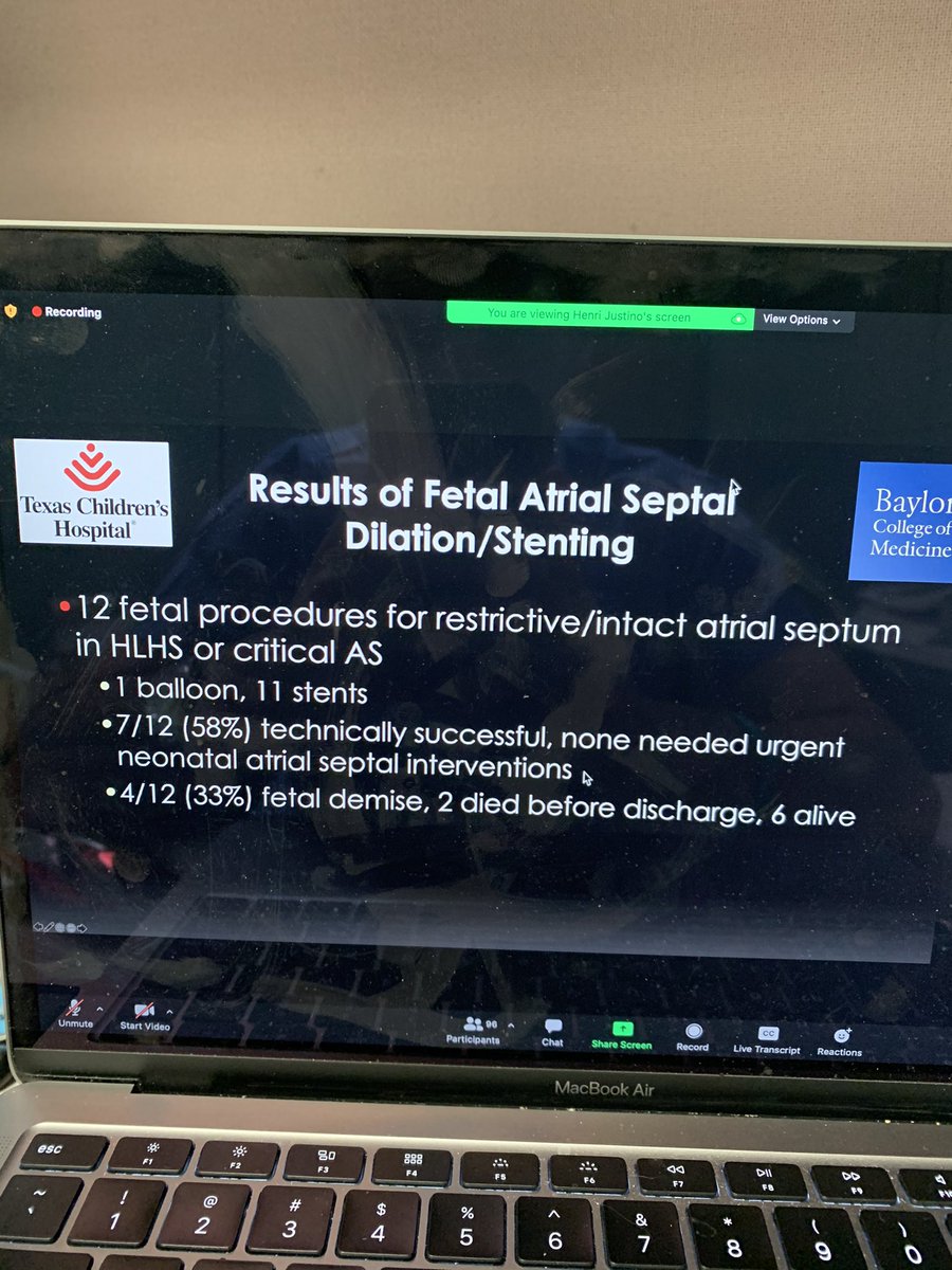 jkurtz02's tweet image. Great session @SCAI by #PICES and Dr Justino on creating a fetal intervention. Still relatively early in our experience but improving outcomes