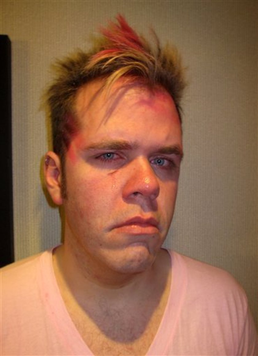 Perez Hilton was even once punched in the face by Will I Am for using a gay slur.  #FreeBritney
