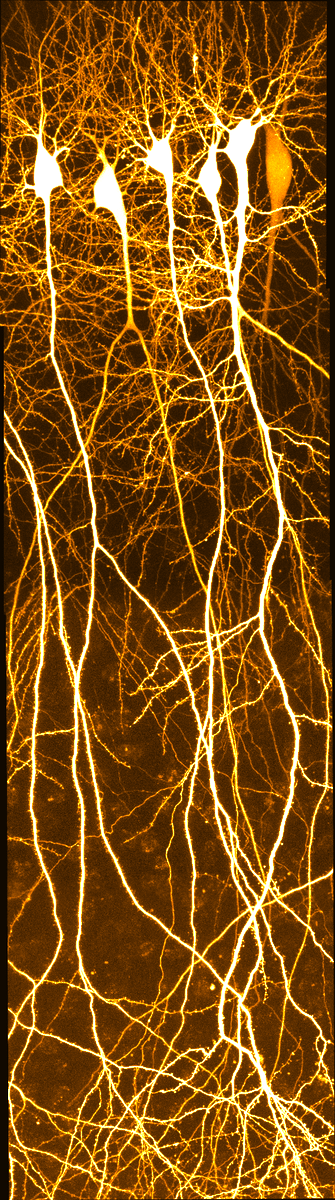 Just some nice CA1 pyramidal neurons for #FluorescentFriday