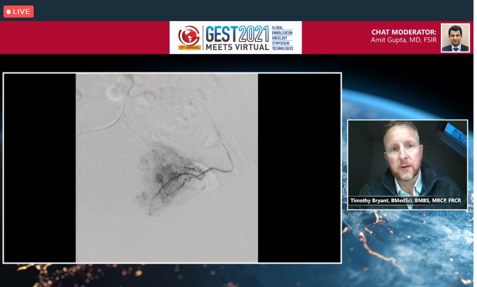 GEST -Global Embolization Symposium & Technologies (@thegestgroup) on Twitter photo Dr. <a href="/BryantTimo/">Timothy Bryant</a> going over PAE case and what/why/tips/tricks of what he uses for embolization particles. #IRad #Iradres #TwittIR Dr. <a href="/BryantTimo/">Timothy Bryant</a> going over PAE case and what/why/tips/tricks of what he uses for embolization particles. #IRad #Iradres #TwittIR