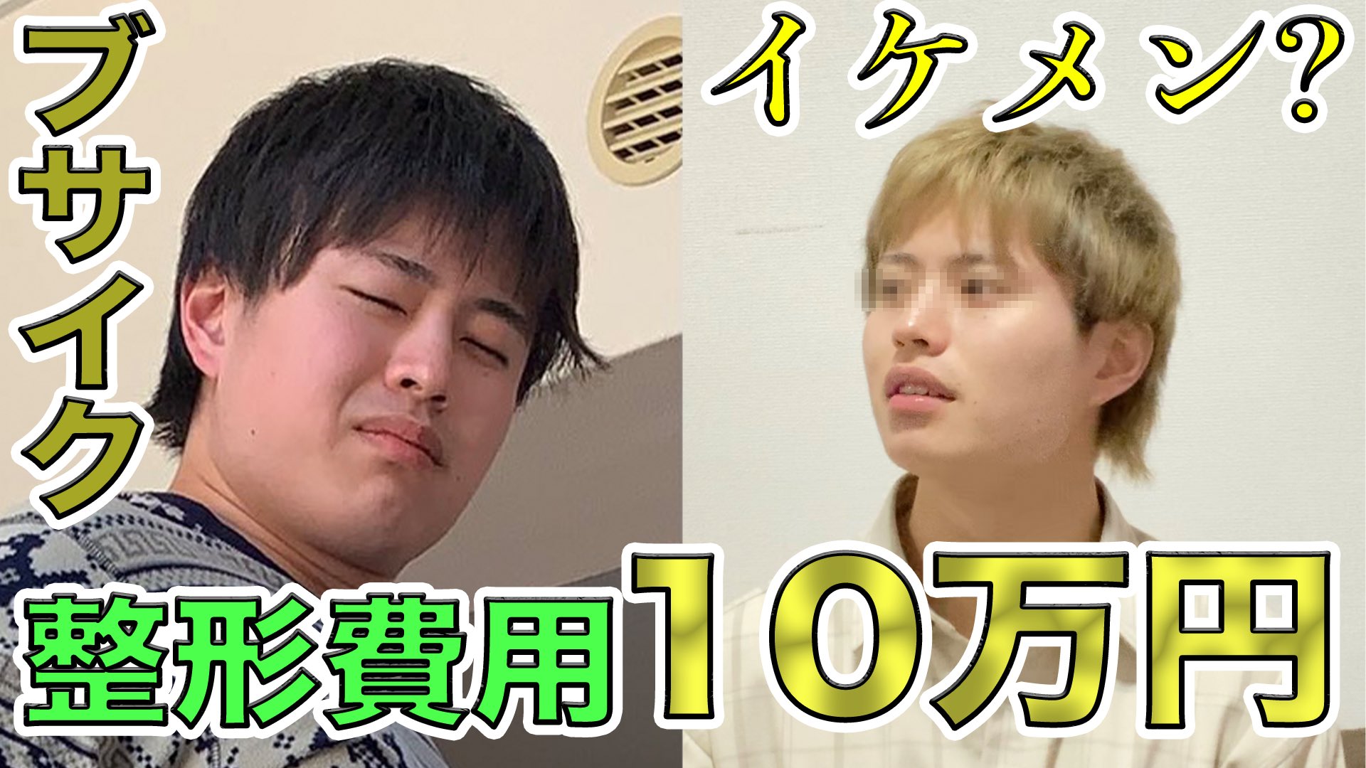 松戸キャンパス 整形しました 二重整形は本当にイケメンになるのでしょうか 気になる方は動画を見てください 整形 二重整形 二重 整形手術 イケメン 検証 大学生と繋がりたい ダウンタイム Youtube 検証 二重整形って本当にイケメンに