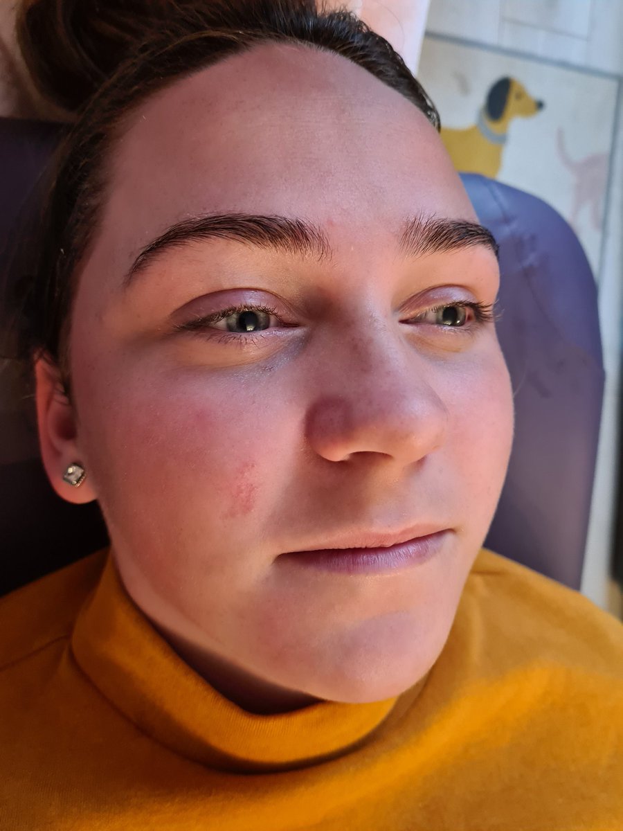 Dermaplaning facial by Lauren 
#facial #dermaplaning #feelfresh 
Facebook:-cushdy Cosmetics 
Instagram:- cushdyCosmetics