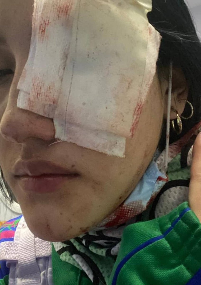 Abuses by the police and public forces of Colombia- 1 woman was sexually abused by a police officer- 7 murdered women- 1 child killed by police shootingHUNDREDS OF PEOPLE INJURED, HIT AND WITH CONTUSIONS  #ColombiaNeedsHelp  #SOSColombiaDDHH