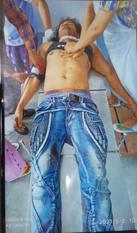 spring21MM's tweet photo. Tw \\ blood, death
Due to Military Terrorists, violently crackdown the protest at #Hpa_Kant,#Kachin State with live ammo, the man in the photo was shot dead &amp; at least 5 people have been injured.
#May2Coup
#WhatsHappeningInMyanmar https://t.co/JOahnFFd5K