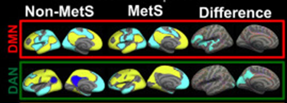 BANDlab (@bandlab_mgh) on Twitter photo Association between metabolic syndrome and resting-state functional brain connectivity
Barnaly Rashid, Elizabeth C. Leritz, et al:
sciencedirect.com/science/articl…
<a href="/barnaly_rashid/">Barnaly Rashid</a> <a href="/RLMikeEsterman/">Mike Esterman</a> <a href="/DavidSalat/">David Salat</a> Association between metabolic syndrome and resting-state functional brain connectivity
Barnaly Rashid, Elizabeth C. Leritz, et al:
sciencedirect.com/science/articl…
<a href="/barnaly_rashid/">Barnaly Rashid</a> <a href="/RLMikeEsterman/">Mike Esterman</a> <a href="/DavidSalat/">David Salat</a>