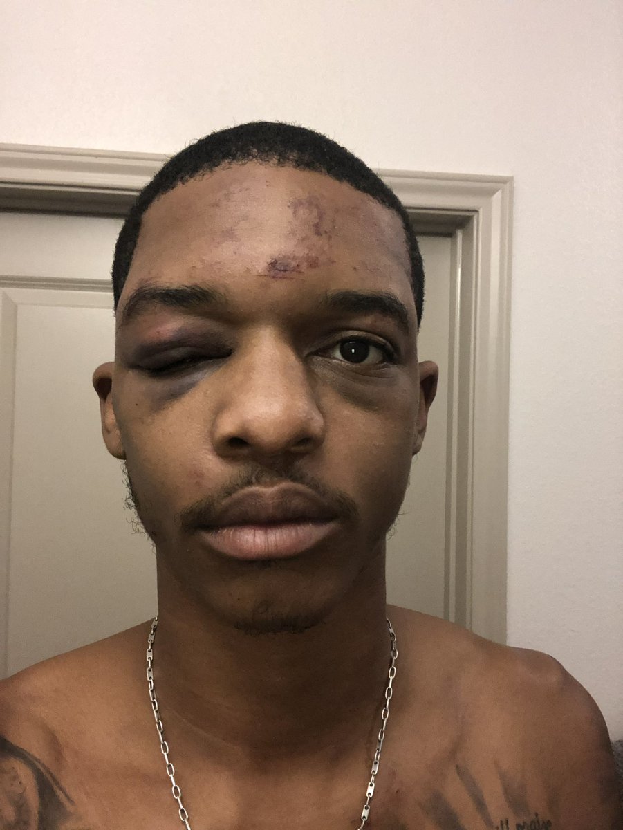 Bstroke17's tweet photo. They been on that.... this happened august 2020.. fuck Huntsville PD https://t.co/ZpU3vCUkPn
