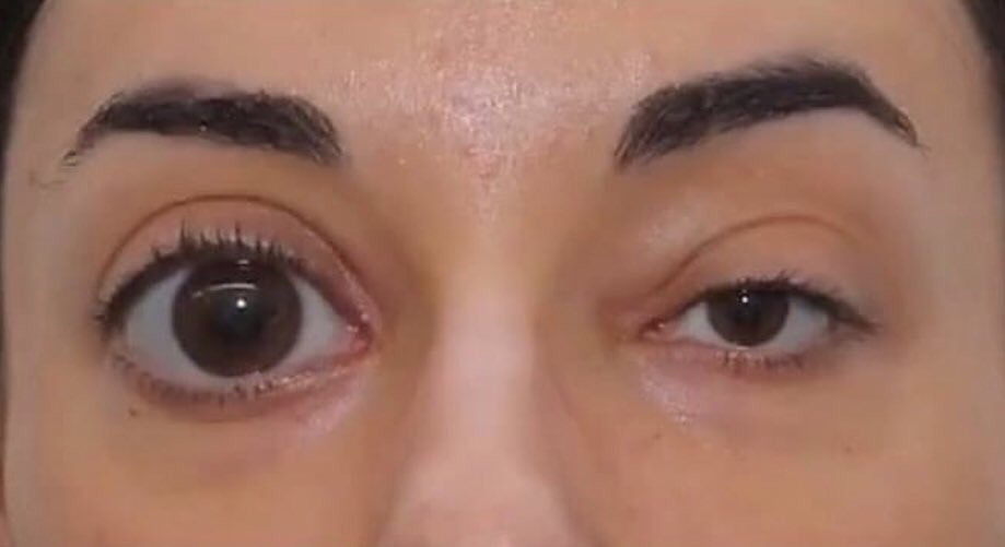 mis ojos en las fotos: