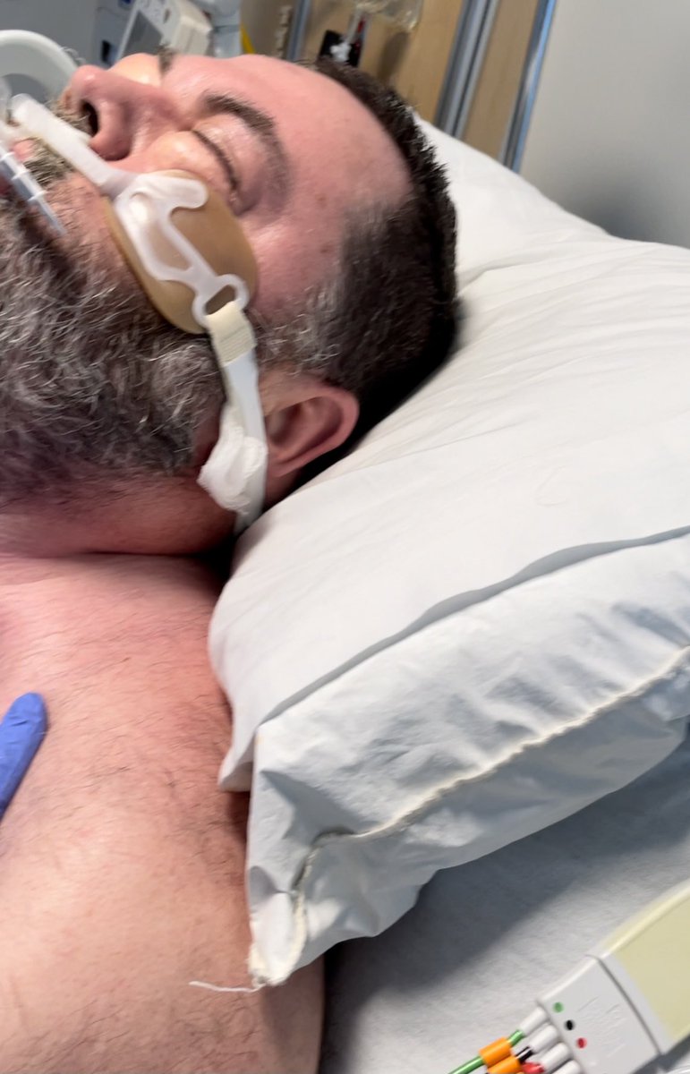 2/ You’ll notice his eyes are swollen shut. (Written perm to show). This is not fluid. It’s AIR from inside his chest leaking out his lungs  through muscles & skin to his neck & into his face. He is AWAKE & communicating but had ICU  #delirium earlier. #MedStudentTwitter  #Nurse