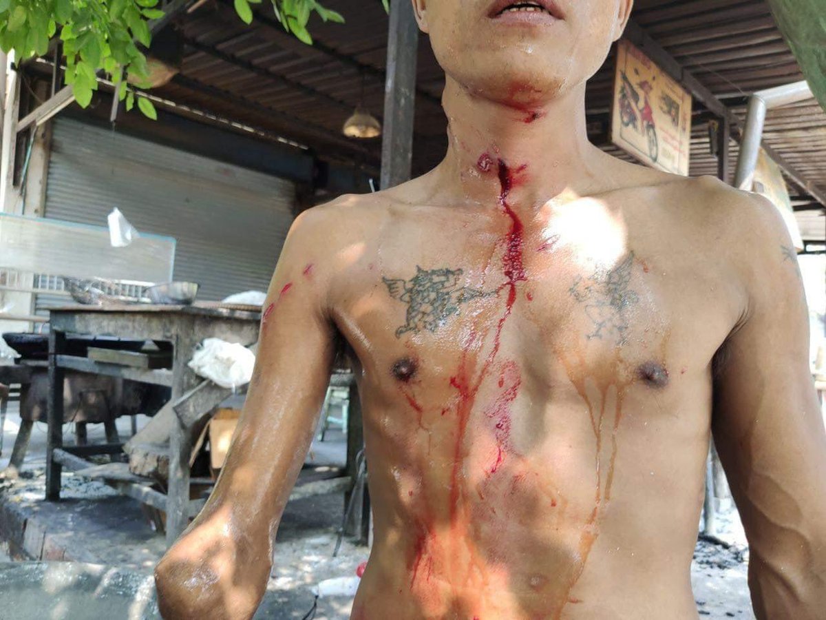 SpringBago's tweet photo. In #WatLat,#Sagaing region, due to brutal shooting of military terrorists, 3 residents were dead and at least 7 injured.
Source- Khin Thit Media
Tw// blood
#May3Coup #WhatsHappeningInMyanmar https://t.co/an1E1LBW4r