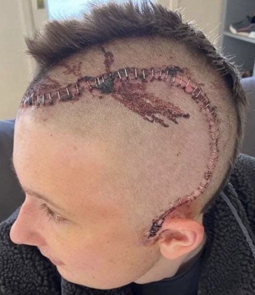 A selection of photos posted online in the last few days.
Brave Coppers who were just doing their jobs.
This is not okay.