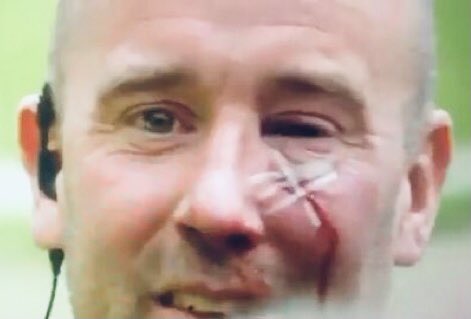 policecommander's tweet photo. A selection of photos posted online in the last few days.
Brave Coppers who were just doing their jobs.
This is not okay. https://t.co/8p1ydb3FwB