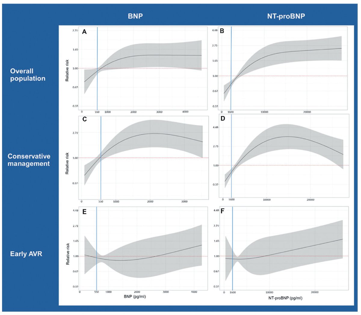 Kardiologie MedUni Wien Forschung (@kardiologiewien) on Twitter photo In patients with low flow, low gradient aortic stenosis, BNP/NT-proBNP may identify high-risk patients who may benefit from early AVR - data from the multicenter TOPAS trial with participation from <a href="/BerglerKlein/">Jutta Bergler-Klein</a> <a href="/pe_bartko/">Philipp E. Bartko</a> <a href="/m_koschutnik/">Matthias Koschutnik</a> <a href="/JMascherbauer/">Julia Mascherbauer</a>
doi.org/10.1080/247487… In patients with low flow, low gradient aortic stenosis, BNP/NT-proBNP may identify high-risk patients who may benefit from early AVR - data from the multicenter TOPAS trial with participation from <a href="/BerglerKlein/">Jutta Bergler-Klein</a> <a href="/pe_bartko/">Philipp E. Bartko</a> <a href="/m_koschutnik/">Matthias Koschutnik</a> <a href="/JMascherbauer/">Julia Mascherbauer</a>
doi.org/10.1080/247487…