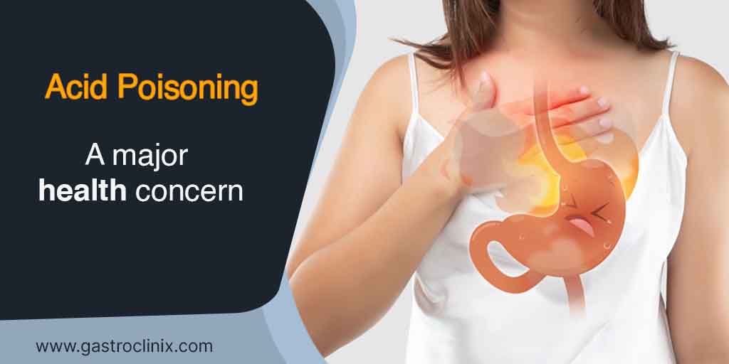 GI_Cancer_Doc's tweet image. ✅Caustic ingestion or acid poisoning is a common problem faced by underdeveloped countries. 

✅Whether it is accidental or suicidal, it leads to a major consequences on health.

✅For more information you can visit: bit.ly/3ahWc8n

#causticingestion #ingestion