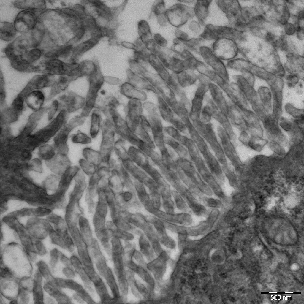 antibody test for covid 19 blood test