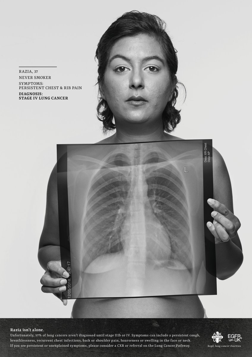 Delighted to launch a new campaign today urging GP's to 'See through the Symptoms' of lung cancer in never-smokers w <a href="/RuthStraussFdn/">Ruth Strauss Foundation</a> &amp; <a href="/UKALK1/">UKALK+</a>. Endorsed by <a href="/lunguk/">British Lung Foundation</a> This is Razia, a mother of 3 Dx at 35yrs  <a href="/BMA_GP/">General Practice</a> <a href="/pulsetoday/">PulseToday</a> <a href="/HSJnews/">Health Service Journal</a> <a href="/Gponlinenews/">GPonline</a> <a href="/Practice_Nurse/">PracticeNurse</a> <a href="/pnursenetwork/">PracticeNurseNetwork</a>