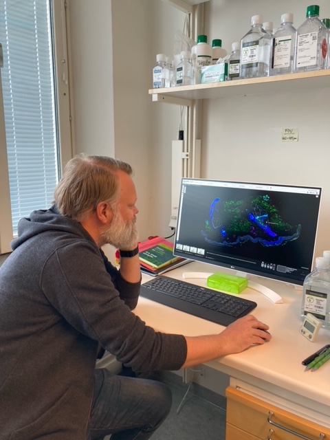 Lars senior lab manager at KIgene Spatial Biology, inspecting skin tissue to be processed in the GeoMx DSP platform from @nanostringtech