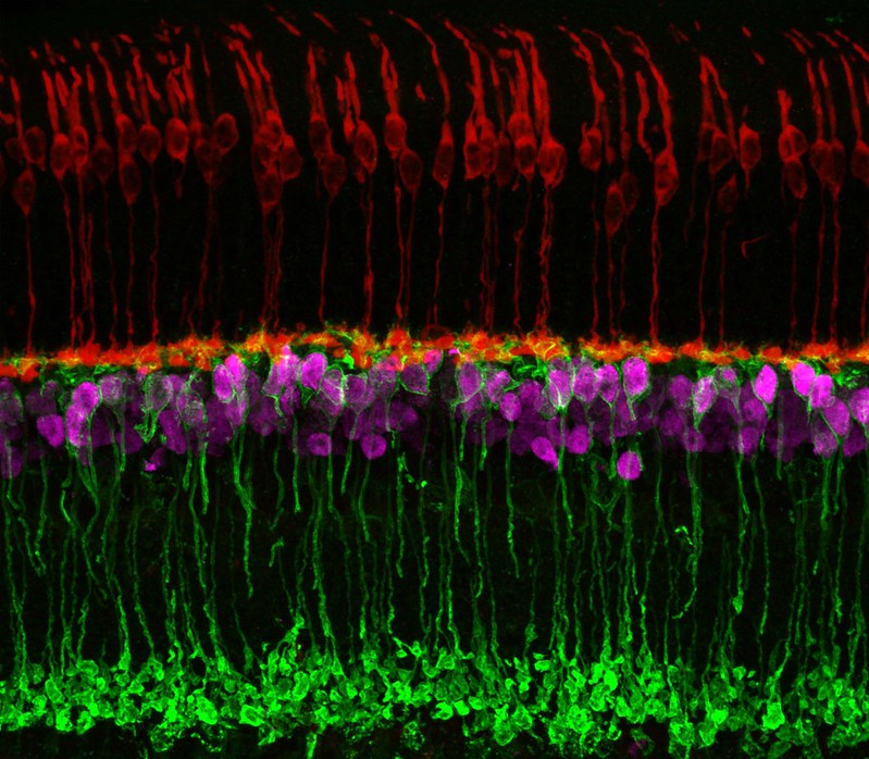 JMG_BMJ's tweet image. #BBS1 branchpoint variant is associated with non-syndromic #RetinitisPigmentosa (#RP)

jmg.bmj.com/content/early/…

@SusanneRoosing @radboudumc @DondersInst @j_ellingford @NWGLH @ucddublin @PhDWithLaura #splicing #ExonSkipping image: mouse retina @NIH