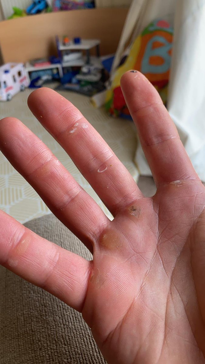 FlyersAtlantic's tweet photo. Row 150km they said. It won’t hurt at all they said....

#ouch #lol #ratherhimthanme https://t.co/DdtWTLUuPP