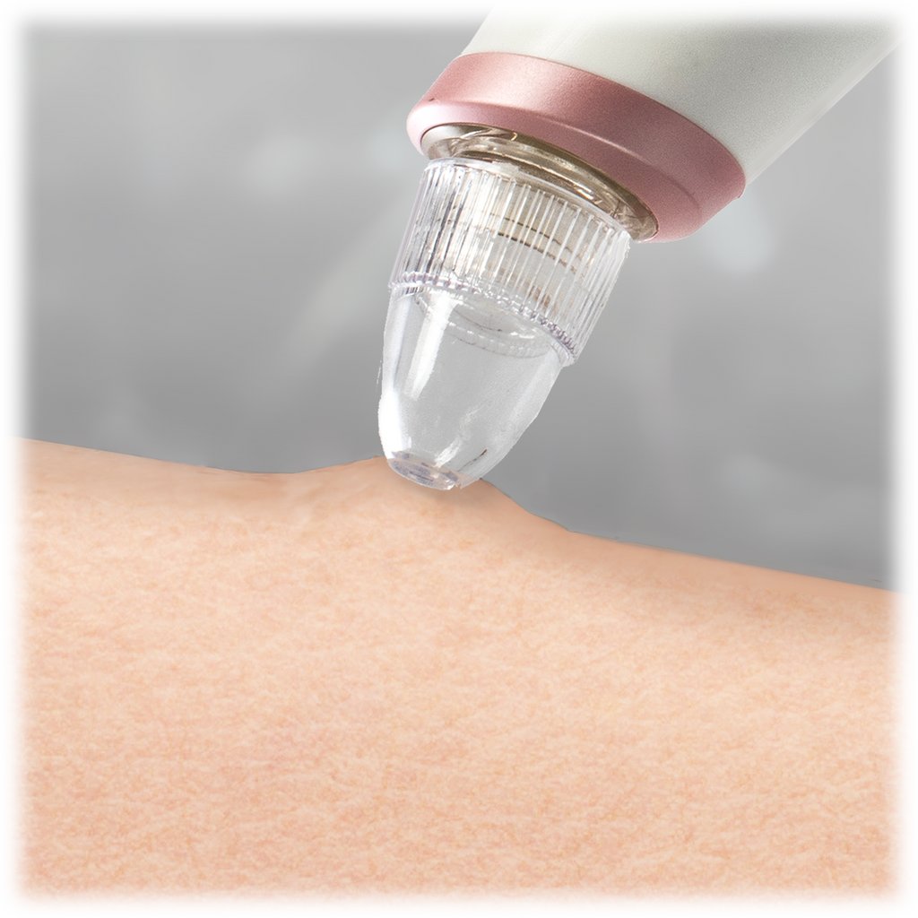 Today’s @morningsave deal is the Brookstone Pore Suction Vacuum Cleanser! It brightens &amp; tightens your skin while removing blackheads and dirt build-up! Plus, it's safe to use and made for all skin types! Want glowing skin for the summer? Get yours today! buff.ly/3nPGFSS