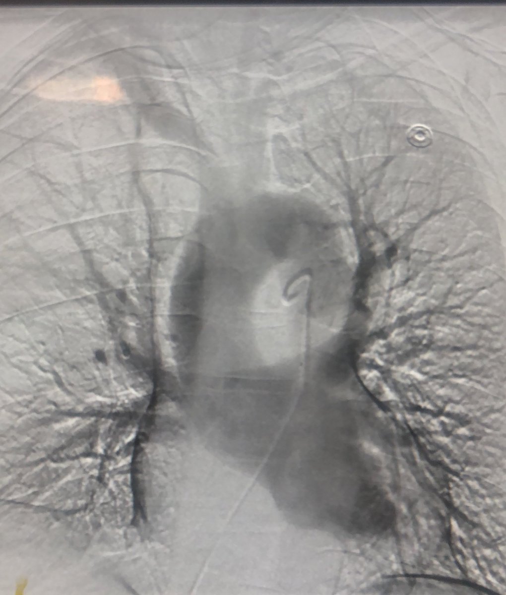 What is wrong with this picture? <a href="/SIRspecialists/">Society of Interventional Radiology</a> <a href="/SIRRFS/">SIR RFS</a> #medtwitter #InterventionalRadiology <a href="/VIR_RUSH/">VIR at RUSH</a>