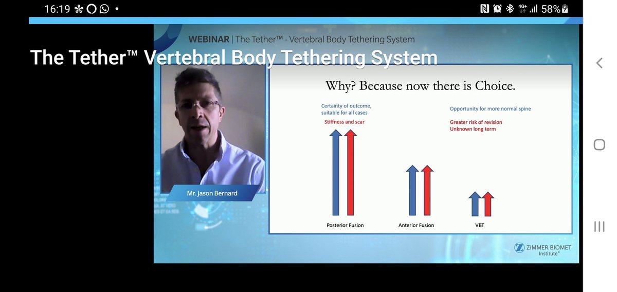 Darren_Lui's tweet image. @WClinics @Gofindout1 @JasonBernard @VBT #theTether
#zimmerbiomet 
Choosing non fusion over fusion in Scoliosis is possible but not for everyone. Great webinar by Jason Bernard on VBT for Scoliosis today with World leading experts