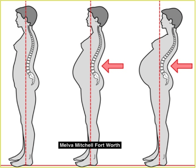 Melva Mitchell Fort Worth How To Fix Your Worst Posture Mistakes. I will discuss some of the most common back pain related to poor posture and how to remedy it.
drmelvamitchell.substack.com/p/melva-mitche…

#melvamitchell #drmelvamitchellfortworth
#chiropractor #chiropractic #texas #texascowboys