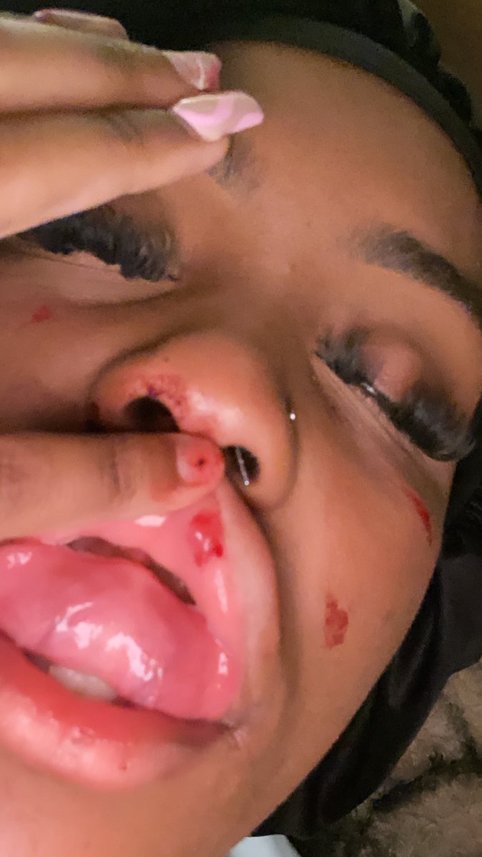 Domestic violence is real . Especially in same sex relationship. And it isn’t addressed enough. Lastnight I experienced something no woman should ever have to experience . My face and neck are bruised cut and I was beaten. I am still in shock.