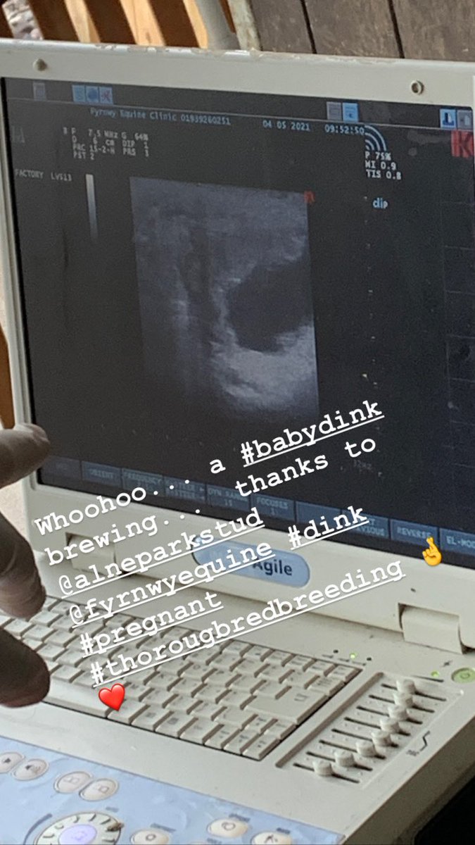 Lovely start to the day - heartbeat scan for Etamine du Cochet - @Alneparkstud #Dink #babydink #somerwoodstud #thoroughbredbreeding #alneparkstud @TheTBA_GB @FyrnwyEquine